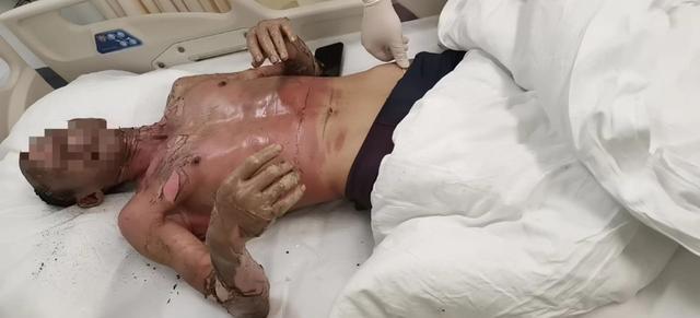 1634177477188986.jpg 2021_1014_44fa7e47j00r0xc0b000mc000hs0083g (1).jpg